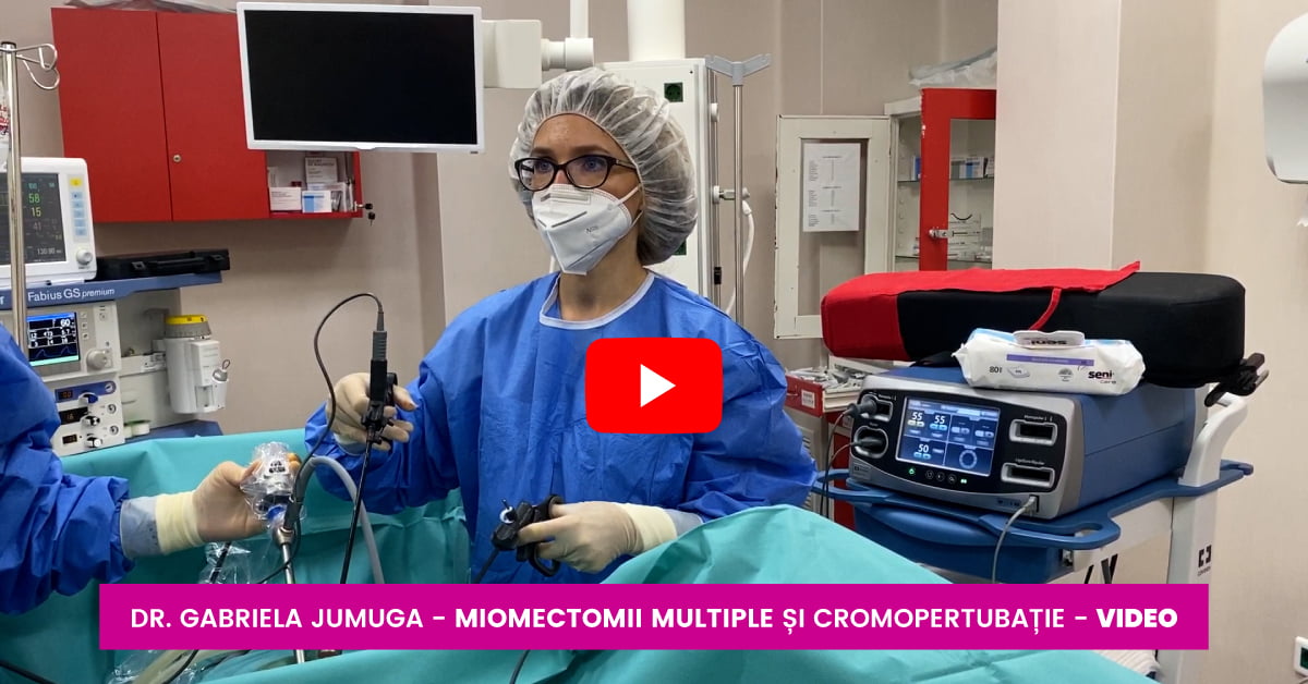 Miomectomii multiple